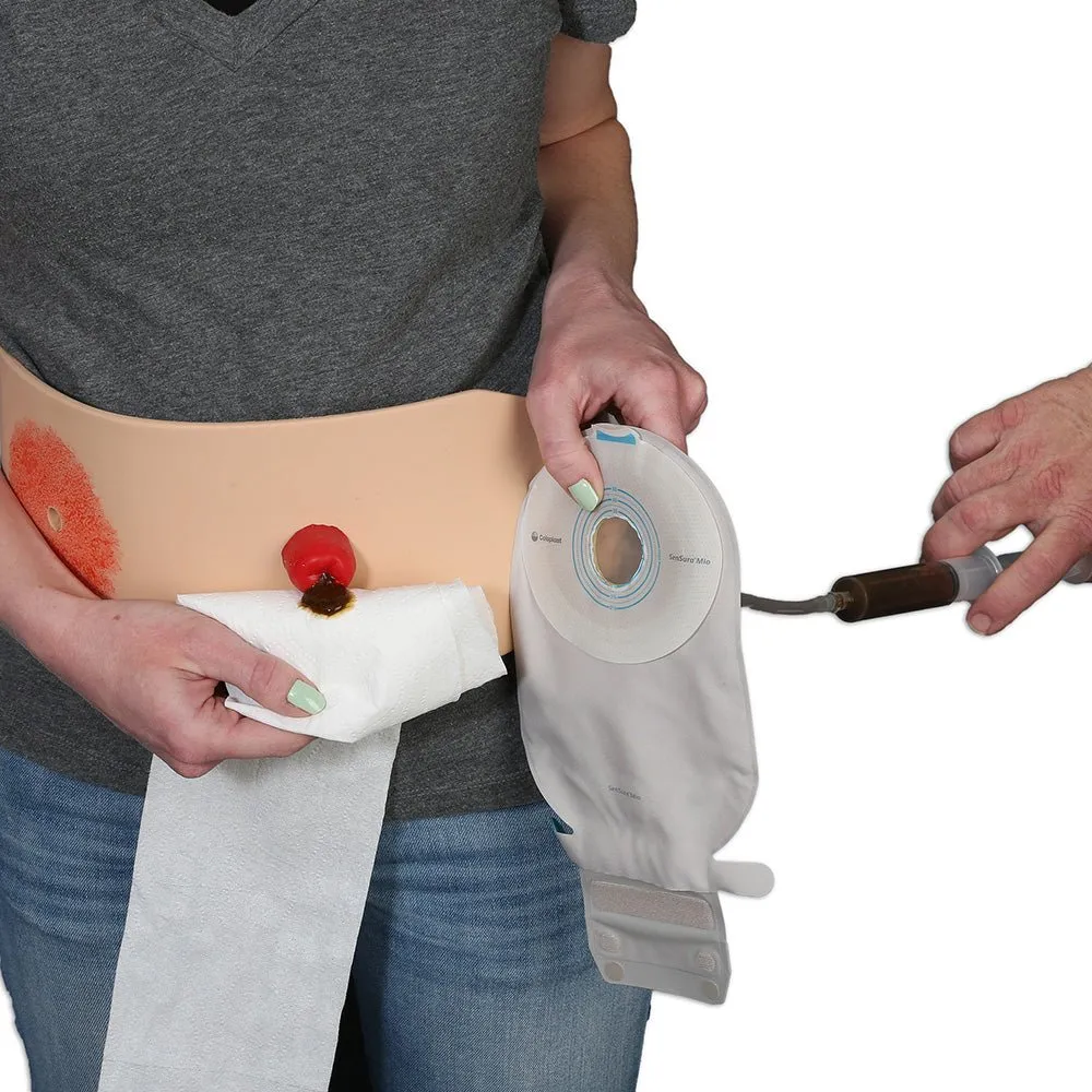 Ostomy Pouching Trainer, Light Skin