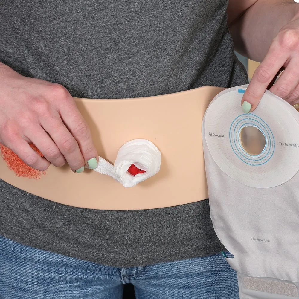 Ostomy Pouching Trainer, Light Skin