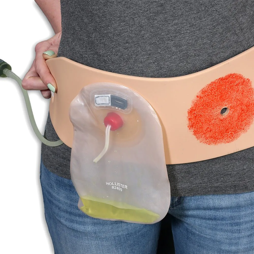 Ostomy Pouching Trainer, Light Skin