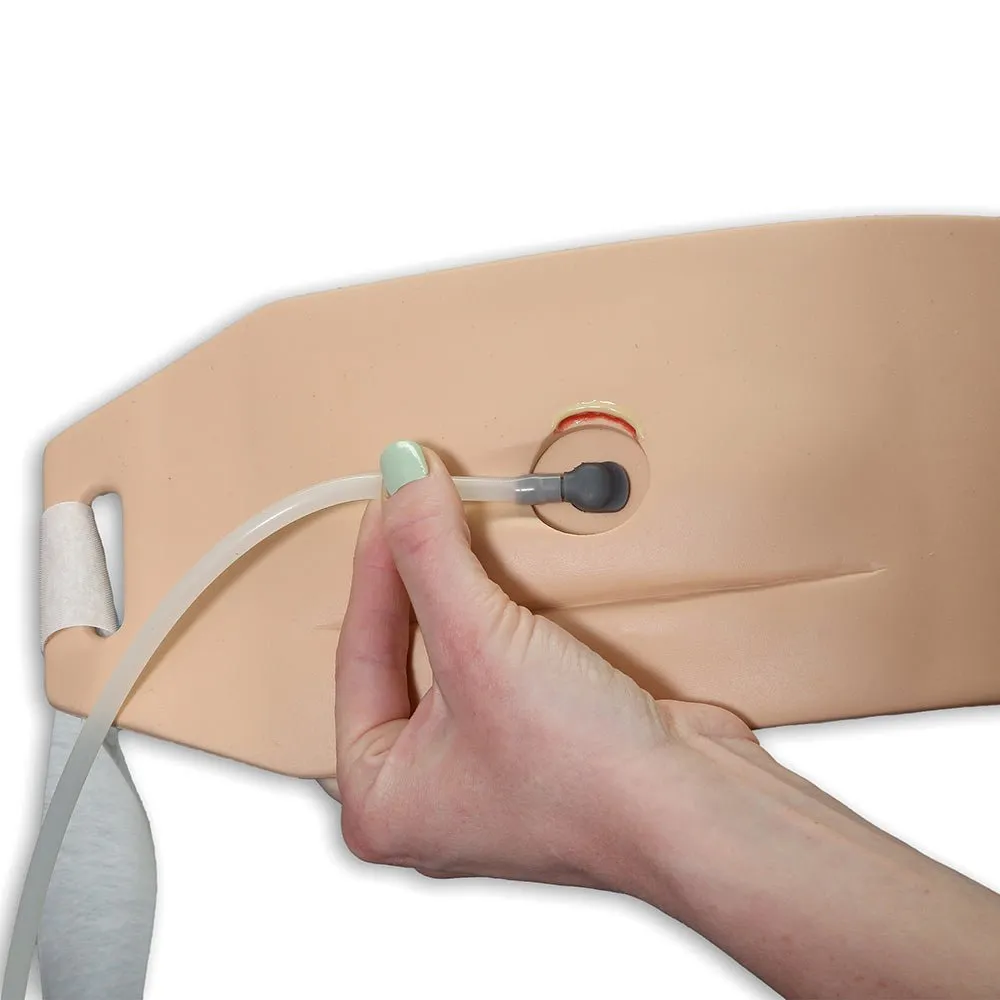Ostomy Pouching Trainer, Light Skin