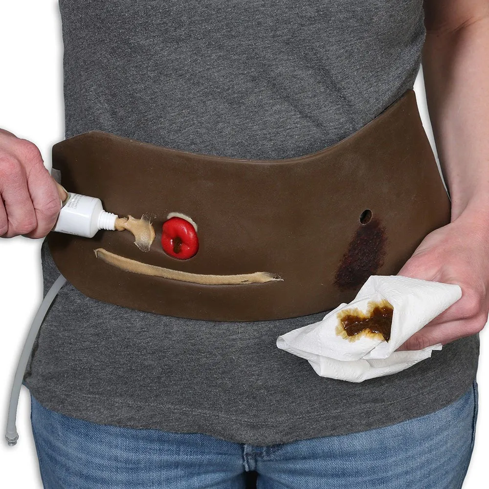 Ostomy Pouching Trainer, Light Skin